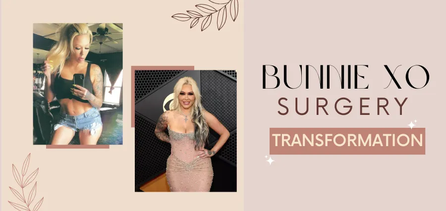 Bunnie XO Surgery transformation